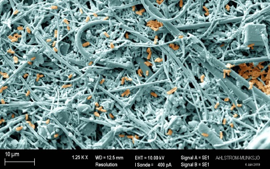 Vrchn� �as� filtra po�as pou��vania